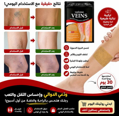 لاصقات الدوالي بتقنية نباتية طبيعية